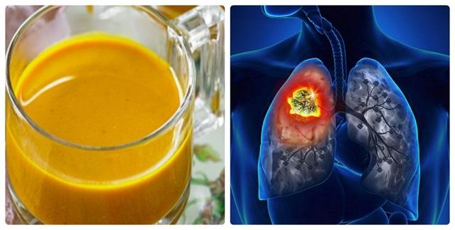 Uống nghệ với thứ này thường xuyên, hiệu quả ngừa ung thư tăng hàng trăm lần