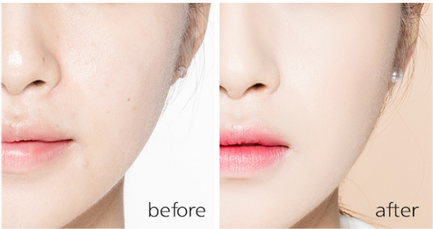 Cách trang điểm hoàn hảo cho nàng có làn da mụn/nám