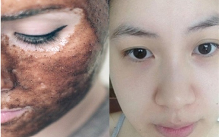 3 Công thức làm mặt nạ tẩy da chết cho làn da mềm mịn như em bé chỉ trong 7 ngày