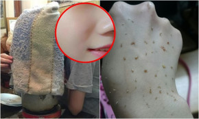 Đun cái này để xông mặt, mụn tự trồi lên, da căng bóng, láng mịn chỉ sau vài lần xông