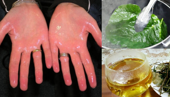 Ai bị mồ hôi tay, chân cứ lấy dùng lá lốt + muối trắng là khỏi tiệt, em đã thử và thành công