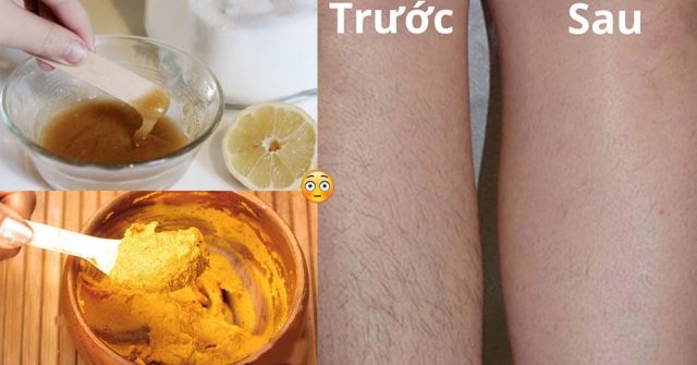 TẨY LÔNG CHÂN VĨNH VIỄN bằng phương pháp dân gian, vừa đơn giản, hiệu quả lại chẳng lo TỐN KÉM, chị em tha hồ xúng xính khoe CHÂN THON