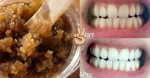 Chỉ ngậm 1 thìa hỗn hợp này răng sẽ TRẮNG SÁNG NHƯ BỌC SỨ, hôi miệng của hết sạch luôn mà chẳng tốn 1 xu đi nha sĩ