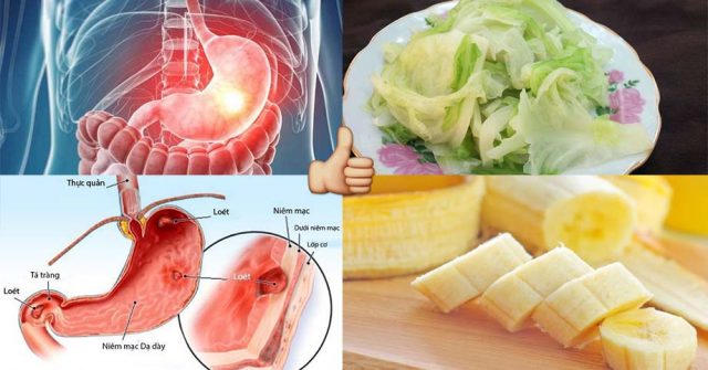 5 thực phẩm được mệnh danh “thần bảo vệ” của DẠ DÀY: Cứ ra chợ là thấy, vừa nhiều vừa rẻ