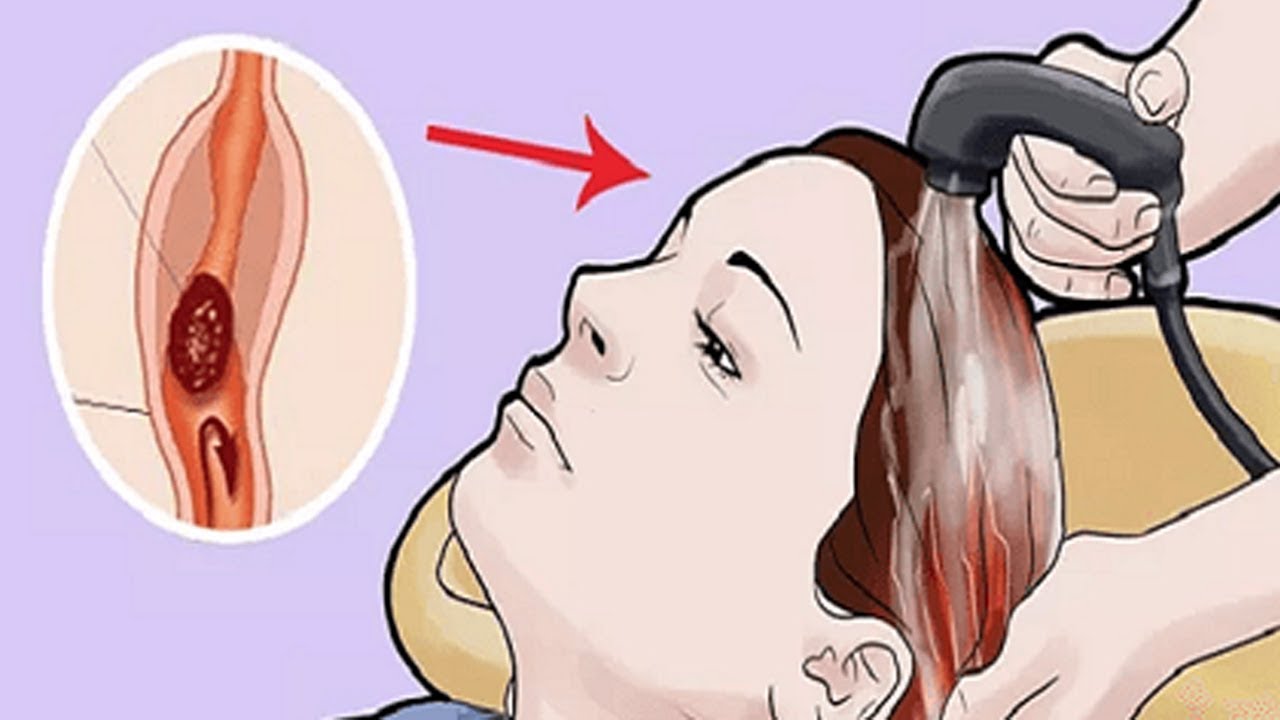 Chớ dại gội đầu vào “8 giờ ĐỘC” này chẳng khác nào TỰ HẠI MÌNH, đầu bẩn cũng chớ làm LIỀU