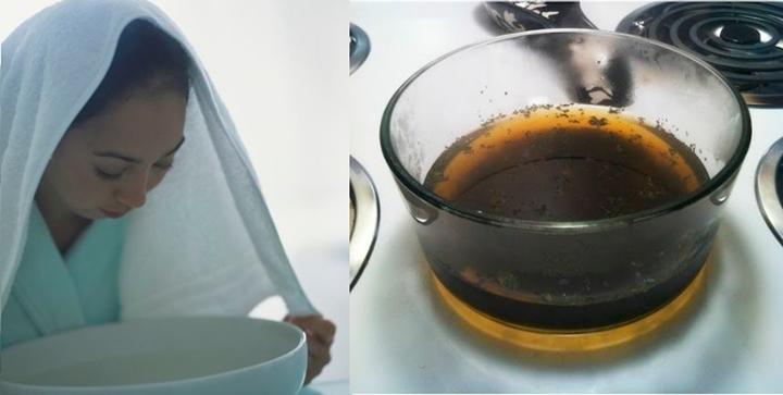 Cách nấu nồi nước xông đúng chuẩn - xông đến đâu mụn trồi ra đến đó