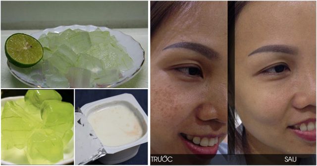 3 cách TRỊ NÁM “tuyệt vời” bằng NHA ĐAM vừa ĐƠN GIẢN lại CỰC KỲ HIỆU QUẢ, chị em không biết sẽ tiếc hùi hụi cho mà xem