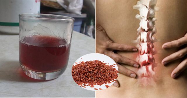 Xin chia sẻ với mọi người thức uống CHỮA HẾT THOÁT VỊ ĐĨA ĐỆM 30 năm, đau nhức xương khớp 13 năm, 100&permil; THÀNH CÔNG