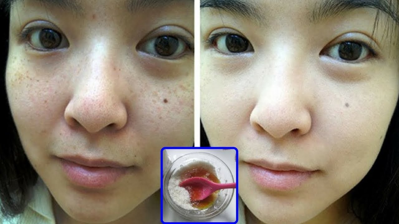 Đừng bỏ lỡ 3 loại bột từ thiên nhiên có công dụng xóa nám, dưỡng trắng da hàng đầu này nhé!