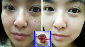 Đừng bỏ lỡ 3 loại bột từ thiên nhiên có công dụng xóa nám, dưỡng trắng da hàng đầu này nhé!