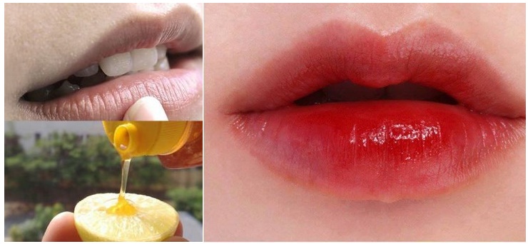 Lấy thứ này đổ lên 1/2 quả chanh rồi chà trong 5 phút, môi THÂM XÌ cũng HỒNG HÀO lên trông thấy chẳng cần đánh son