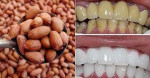 Răng trắng bóc, cao răng bong ra tức khắc chỉ nhờ nhai nhúm lạc sống rẻ tiền theo cách này