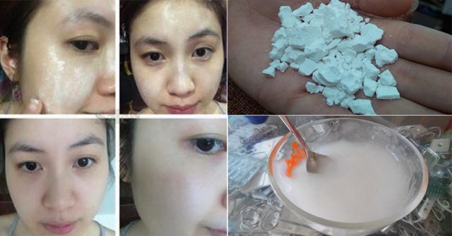 Nhà có bột sắn dây mà không biết cách dùng để LỘT XÁC từ trong ra ngoài thì đúng là LÃNG PHÍ