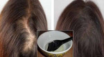 4 Cách chấm dứt ngay tình trạng RỤNG TÓC cho mọi chị em bằng phương pháp từ thiên nhiên