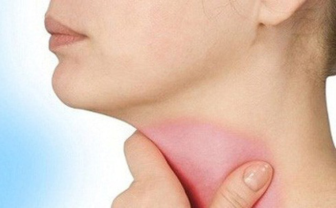 3 “thủ phạm” gây ung thư thực quản: Ai cũng nên biết để phòng ngừa