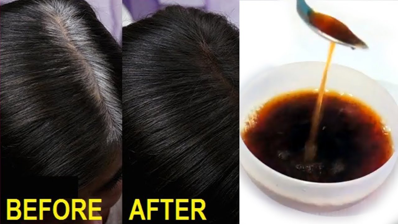 5 Mẹo đánh bay mái tóc lốm đốm bạc và đạt được mái tóc dày đẹp, chắc khỏe cực đơn giản