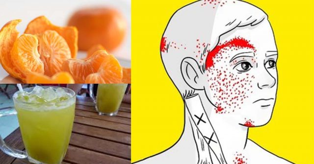 7 SAI LẦM trong ăn uống là nguyên nhân gây ĐAU NỬA ĐẦU nghiêm trọng, hãy thay đổi ngay khi còn có thể