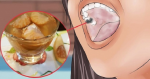 Bài thuốc quá dễ trị răng lung lay ê buốt, tới già răng vẫn không rụng