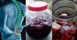 Hành tây + rượu vang = Công thức CHỮA DỨT ĐIỂM bệnh đau xương khớp, tê liệt hiệu quả