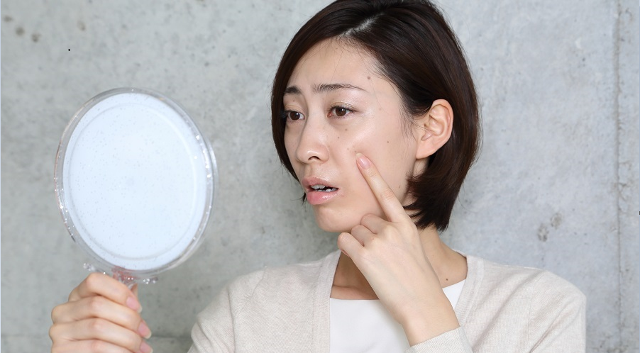 Chị 2 em miền Bắc- Trung phát sốt với cách trị nám được chị em trong Nam chia sẻ rần rần