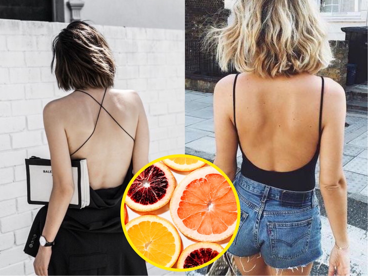 Công thức trị sạch mụn ở vùng lưng chỉ trong vài ngày