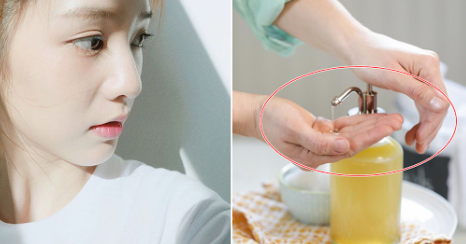 Thoát khỏi làn da dầu mụn nhờ công thức tự làm sửa rửa mặt handmade cho da nhờn