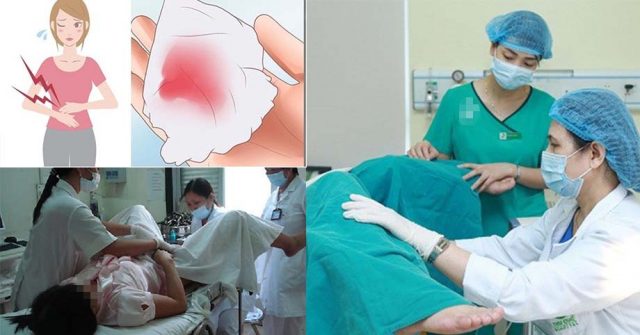 5 điều nên biết trước khi đi KHÁM PHỤ KHOA để có được kết quả chẩn đoán chính xác nhất