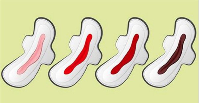 Phụ nữ chú ý: Màu sắc kinh nguyệt tiết lộ tình trạng sức khỏe của bạn