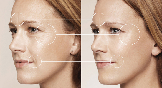 Phụ nữ nhất định phải biết 3 loại nước uống này cung cấp collagen tự nhiên, ngăn ngừa lão hóa