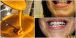 4 Công thức ĐƠN GIẢN với những nguyên liệu RẺ TIỀN giúp bạn luôn trắng răng thơm miệng
