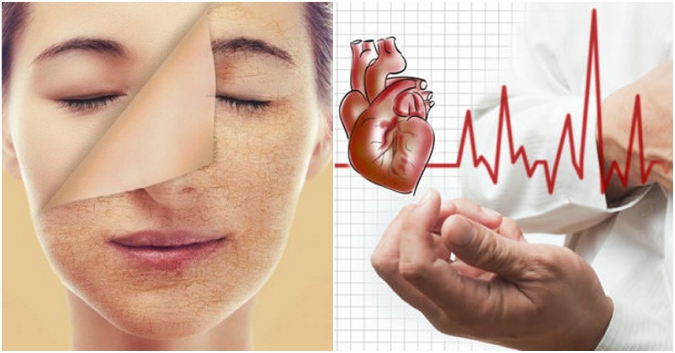 CẢNH BÁO: Đi ngủ sau 23 giờ đêm sớm muộn gì cũng phải đối mặt với 7 căn bệnh nguy hiểm này