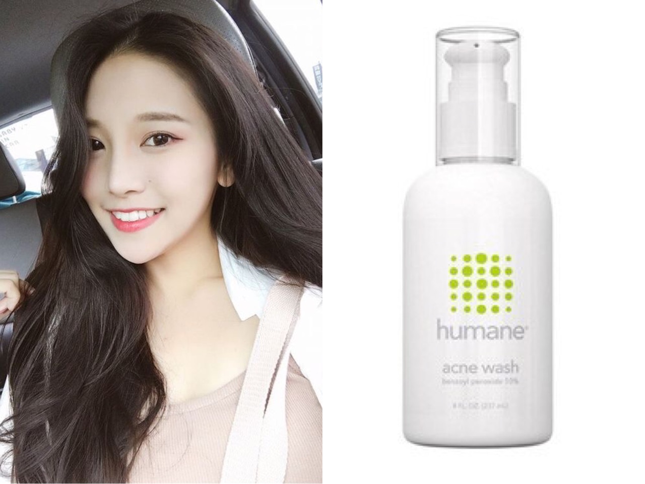 Đây là thàn phần “thần thánh” trong sản phẩm trị mụn mà bác sĩ da liễu khuyên dùng hàng ngày