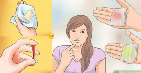 Nghe BÁC SĨ CHUYÊN KHOA tiết lộ những bí mật ẩn chứa trong từng loại DỊCH ÂM ĐẠO, chị em đối chiếu xem có ĐÁNG LO không nè!!!