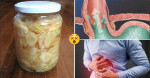 “Chấm dứt” bệnh TRÀO NGƯỢC DẠ DÀY hiệu quả sau 3 ngày chỉ với công thức ĐƠN GIẢN DỄ LÀM này!