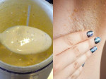 4 hỗn hợp tự nhiên làm sạch lông nách hiệu quả nhanh và rất dễ làm