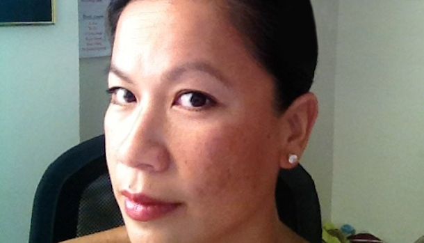 30 NGÀY GIẢM NÁM DA HIỆU QUẢ VỚI LIỆU TRÌNH KHOA HỌC