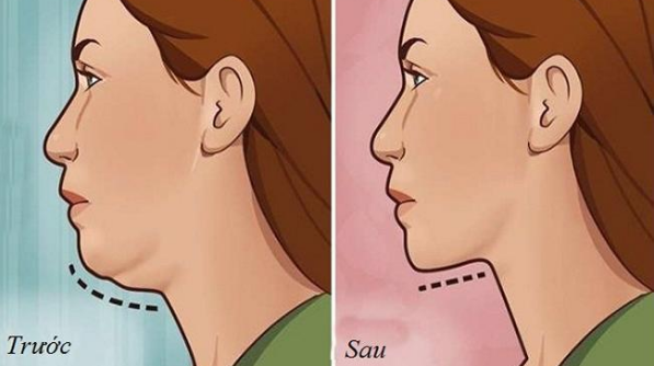 Mỡ thừa quanh cổ, nọng cằm dày mấy ngấn cũng &rsquo;một đi không trở lại&rsquo; nhờ 5 động tác yoga này