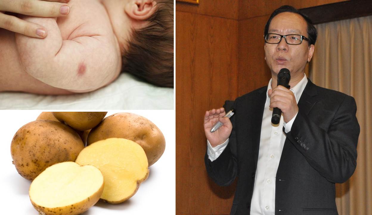 Nếu mẹ dùng lòng trắng, lá thuốc, khoai tây... đắp vết tiêm, con có thể lãnh đủ hậu quả