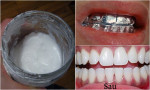 Lấy giấy bạc quấn quanh răng trong 5 phút, răng trắng sạch gấp 5 lần đi nha sĩ