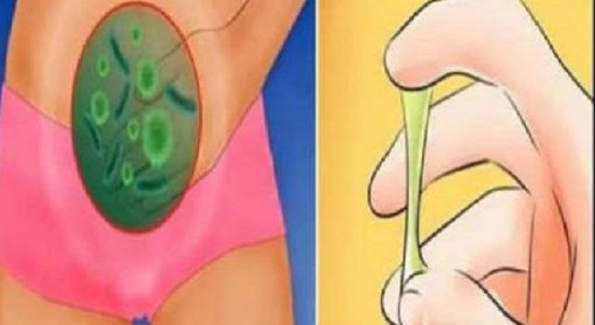 Những nguyên nhân nào làm tăng nguy cơ mắc bệnh ung thư cổ tử cung?