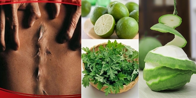 Bưởi + chanh + ngải cứu = THUỐC cực mạnh chữa dứt GAI CỘT SỐNG, đau chết đi sống lại cũng KHOAN KHOÁI lập tức, kiên trì thì kiểu gì cũng khỏi bệnh