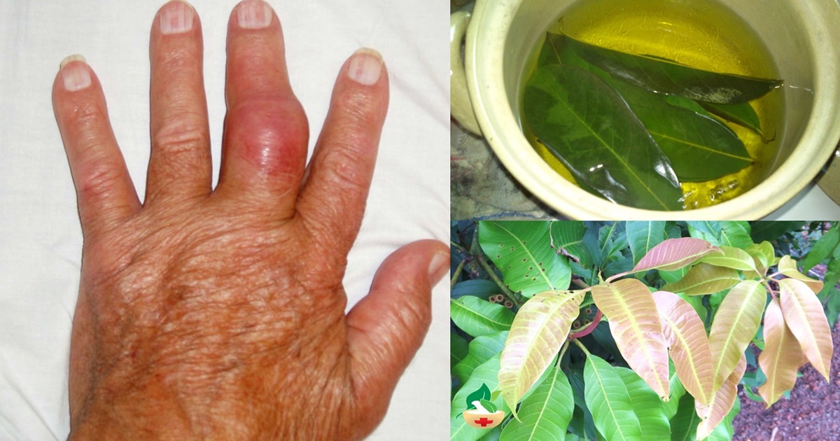 Lá xoài non chữa tiểu đường cực hiệu quả, khoa học đã chứng minh!