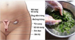 Ai bị viêm nhiễm, ngứa ngáy suốt ngày vào đây em mách cho, rửa thứ nước này đỡ ngay lần đầu, thêm vài lần sau là khỏi hẳn luôn