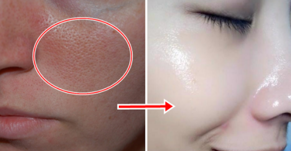 Bỏ lon soda vào tủ lạnh 5 phút rồi lấy nước ra ngâm mặt, lỗ chân lông tự động thu nhỏ sau 1 đêm