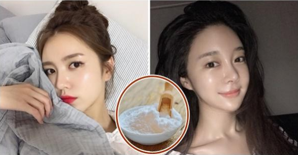 3 cách trị mụn hiệu quả cho da nhờn đơn giản tại nhà