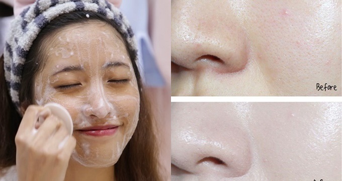 10 Mẹo đơn giản thu nhỏ lỗ chân lông cho da mịn hơn