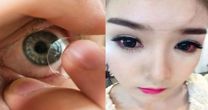 Bác sĩ cảnh báo: Đừng ham hố đeo kính áp tròng làm đẹp nữa nếu không muốn nhiễm trùng, mù mắt vĩnh viễn, ôm hận cả đời