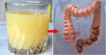 Chỉ mất 5 phút/ngày lọc sạch ruột già, ngăn ngừa ung thư, giảm cân hiệu quả sau 1 tuần dùng thức uống này