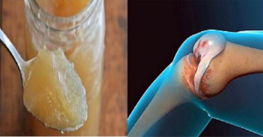 Chỉ cần 2 muỗng,ngày, đau nhức xương khớp nặng đến cỡ nào cũng khỏi trong vòng 7 ngày