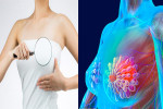 Đừng dại làm 7 điều này với &rsquo;nhũ hoa&rsquo; nếu không muốn ung thư vú tìm đến bạn